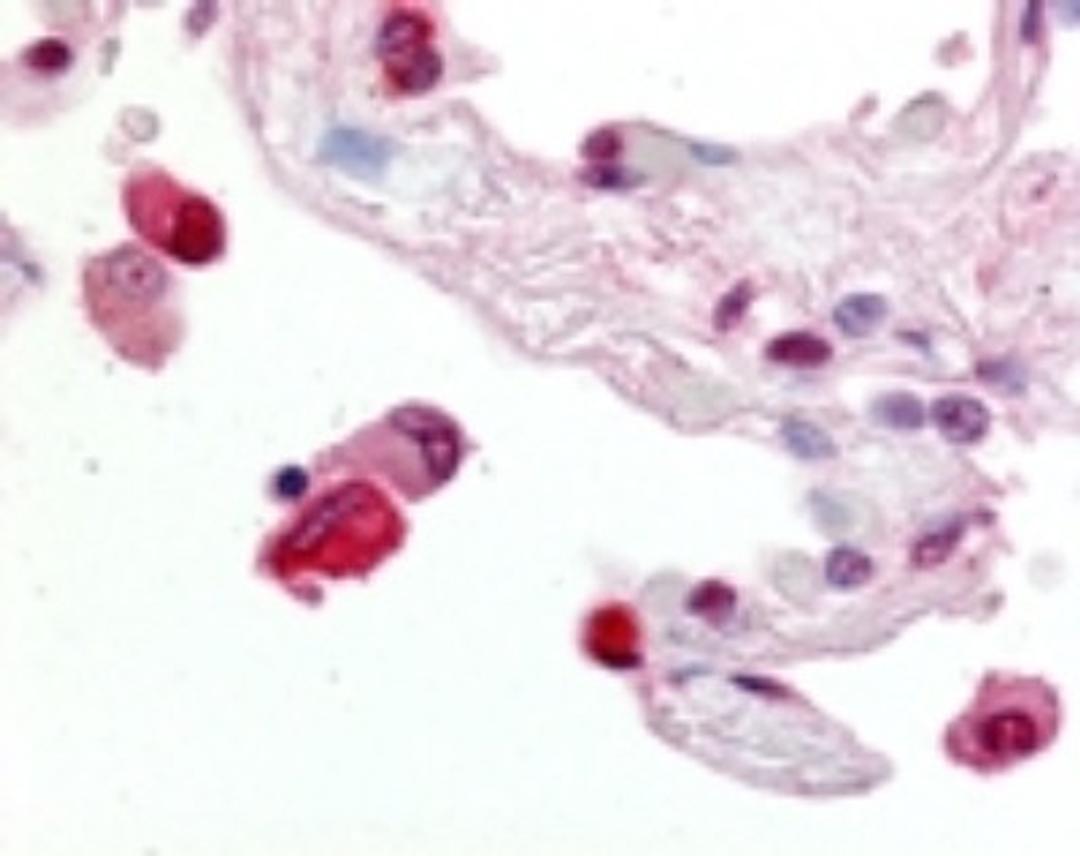 Immunohistochemistry: ABCG1 Antibody [NB400-132] - Analysis using the Biotin conjugate of NB400-132. Staining of lung, alveolar macrophages.