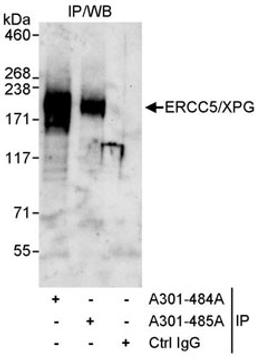 Detection of human ERCC5/XPG by western blot of immunoprecipitates.