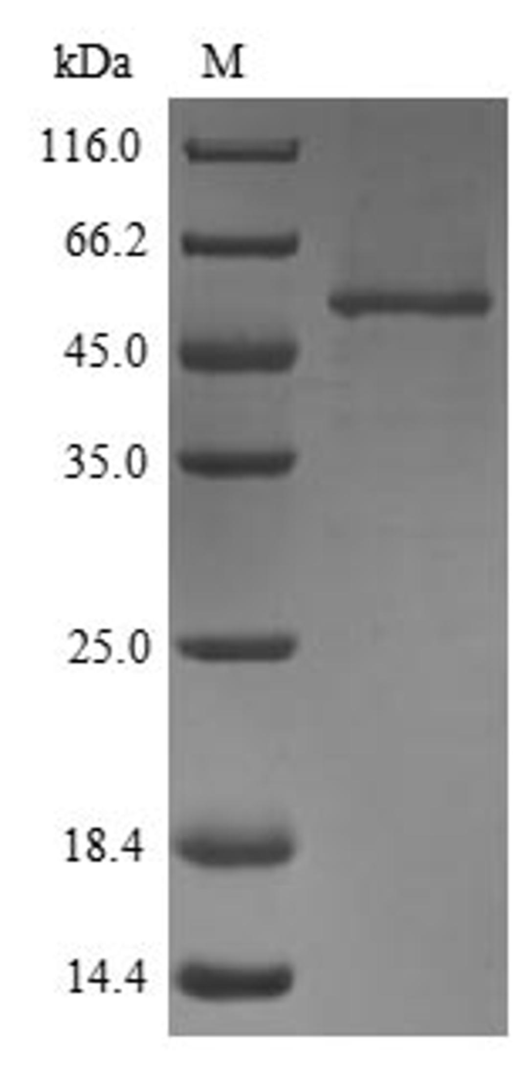 (Tris-Glycine gel) Discontinuous SDS-PAGE (reduced) with 5% enrichment gel and 15% separation gel.
