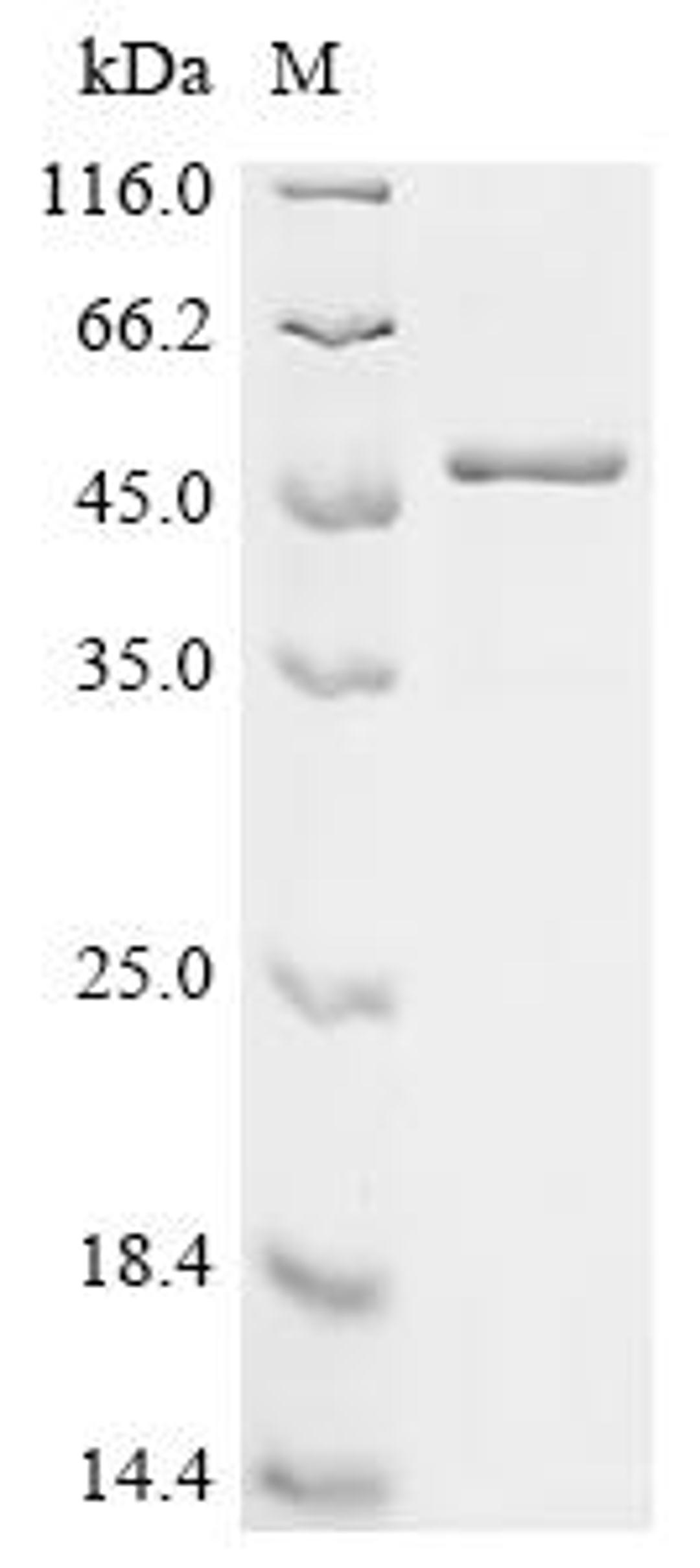 (Tris-Glycine gel) Discontinuous SDS-PAGE (reduced) with 5% enrichment gel and 15% separation gel.
