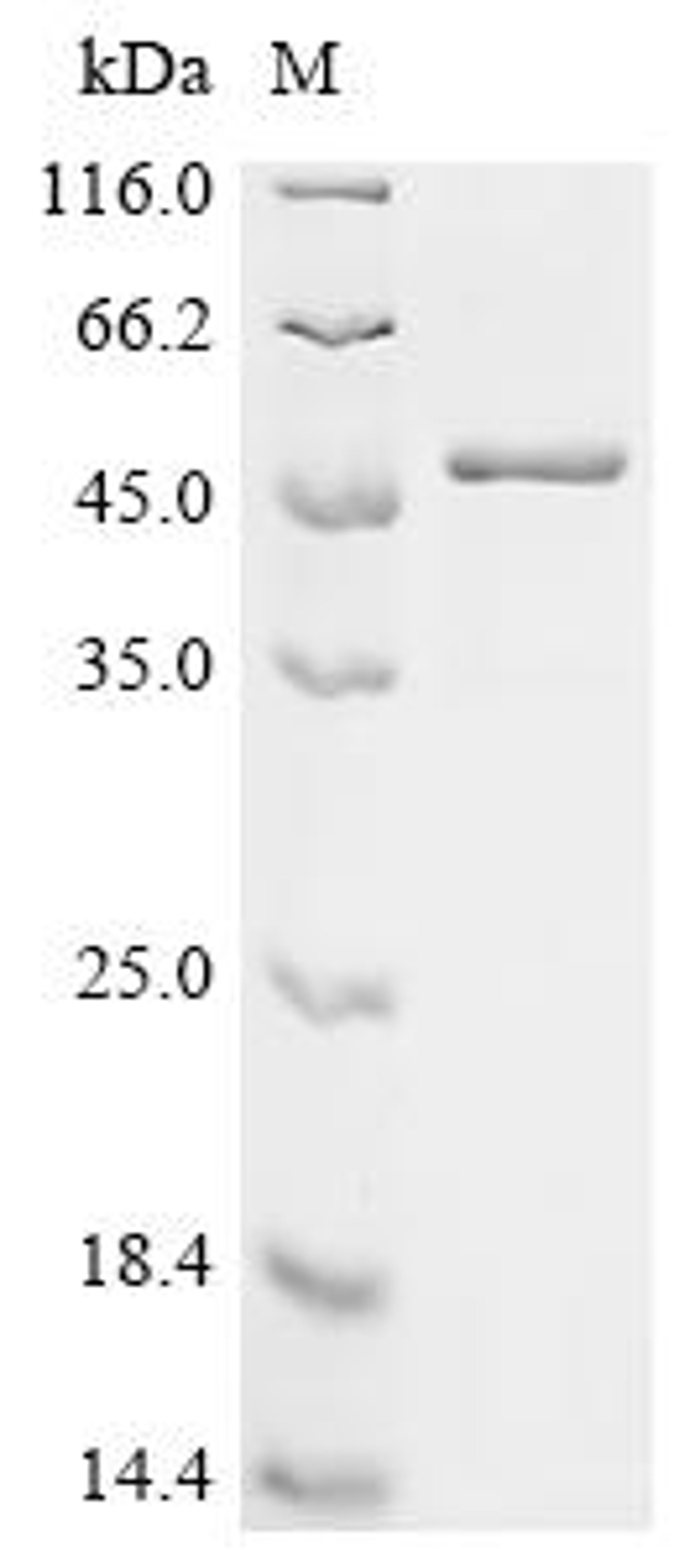 (Tris-Glycine gel) Discontinuous SDS-PAGE (reduced) with 5% enrichment gel and 15% separation gel.