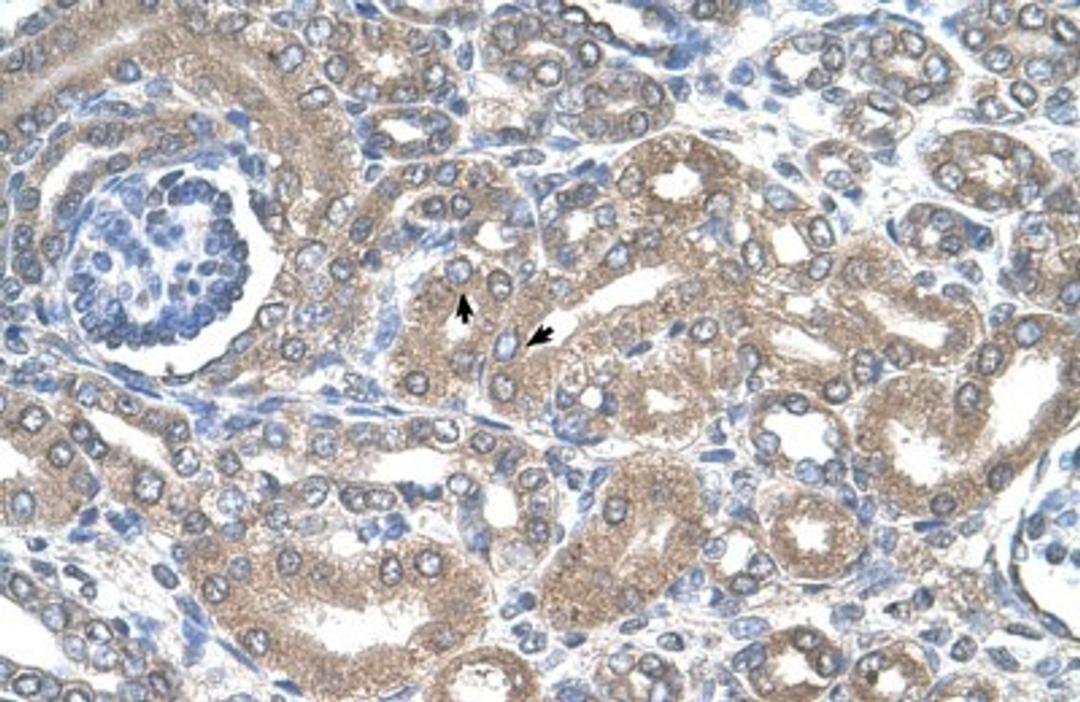 Immunohistochemistry-Paraffin: NKCC2/SLC12A1 Antibody [NBP1-57622] - Human kidney Tissue, antibody concentration 4-8ug/ml. Cells with positive label: renal corpuscle cells (indicated with arrows) 400X magnification.