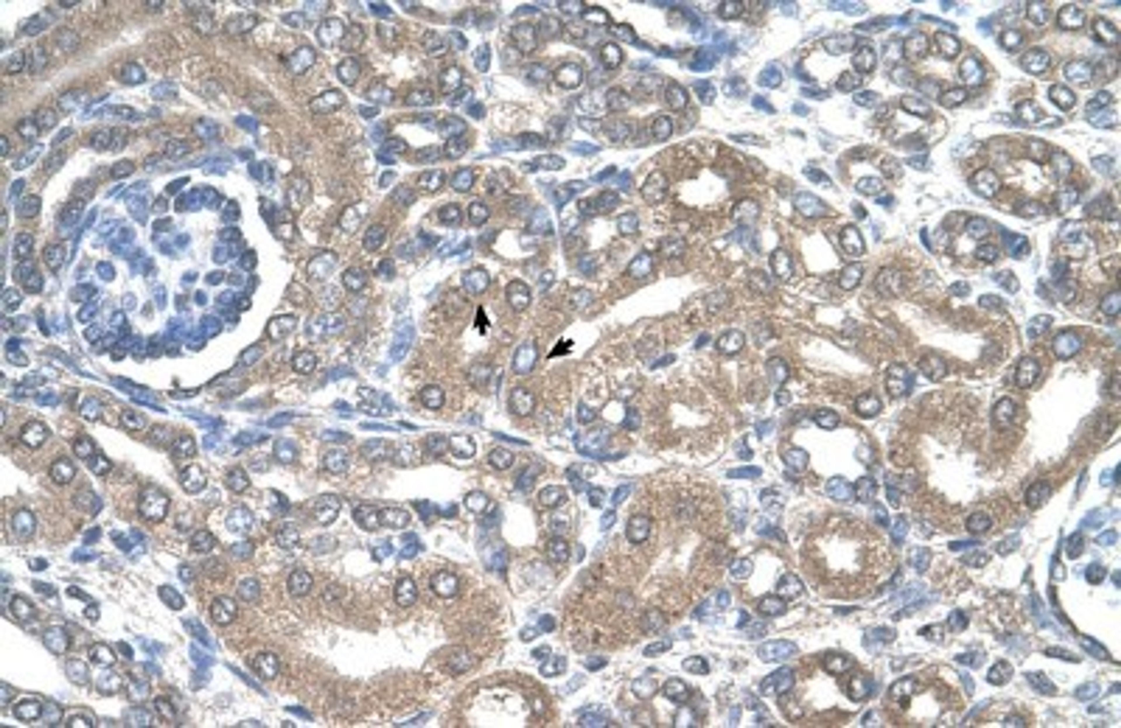 Immunohistochemistry-Paraffin: NKCC2/SLC12A1 Antibody [NBP1-57622] - Human kidney Tissue, antibody concentration 4-8ug/ml. Cells with positive label: renal corpuscle cells (indicated with arrows) 400X magnification.