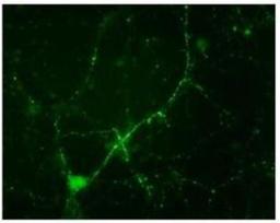 Immunocytochemistry/Immunofluorescence: Synapsin I [p Ser549] Antibody [NB300-744] - Immunostaining of cultured mouse caudate neurons showing synapsin I when hosphorylated at Ser549.