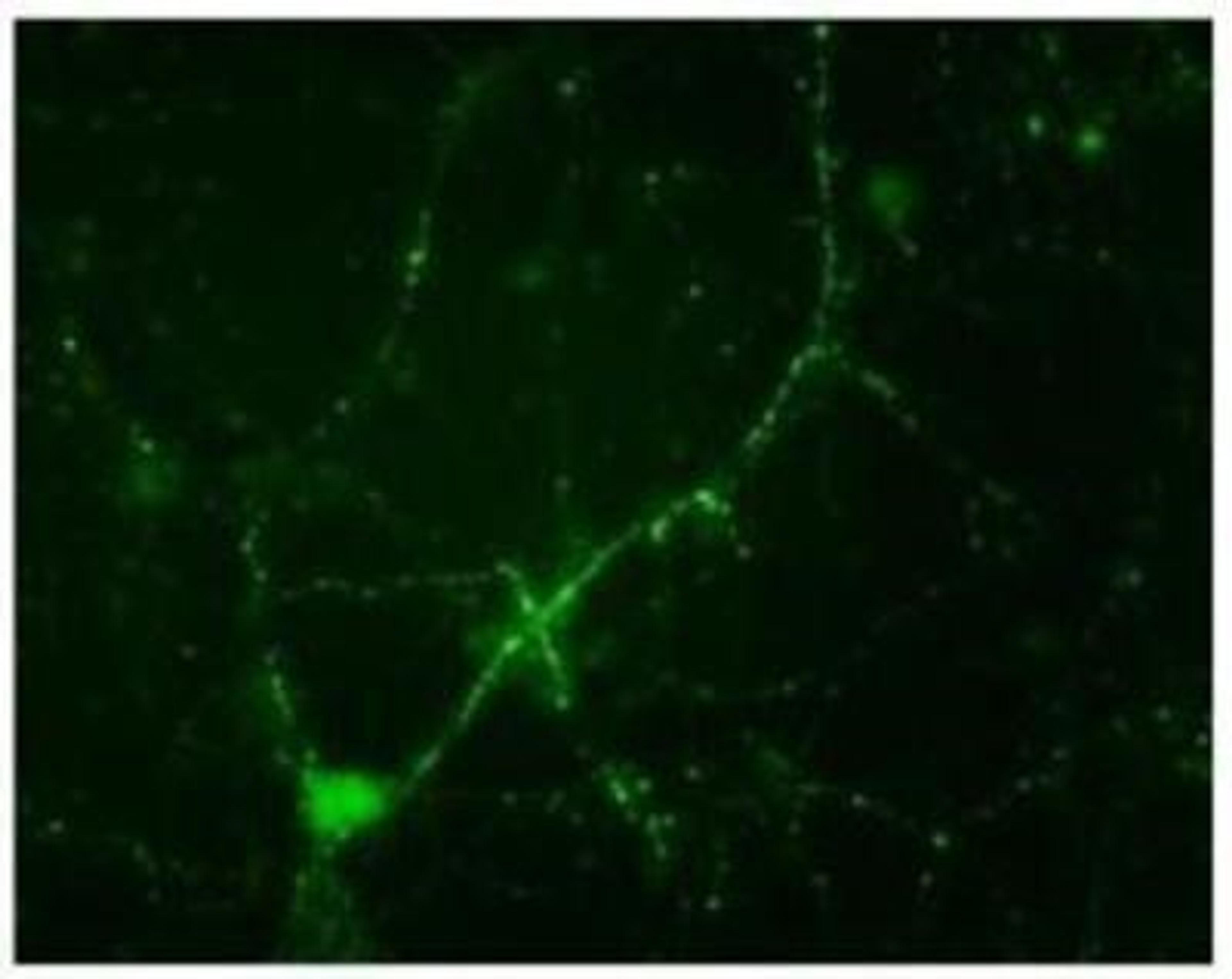 Immunocytochemistry/Immunofluorescence: Synapsin I [p Ser549] Antibody [NB300-744] - Immunostaining of cultured mouse caudate neurons showing synapsin I when hosphorylated at Ser549.