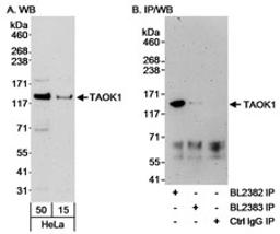 Detection of human TAOK1 by western blot and immunoprecipitation.