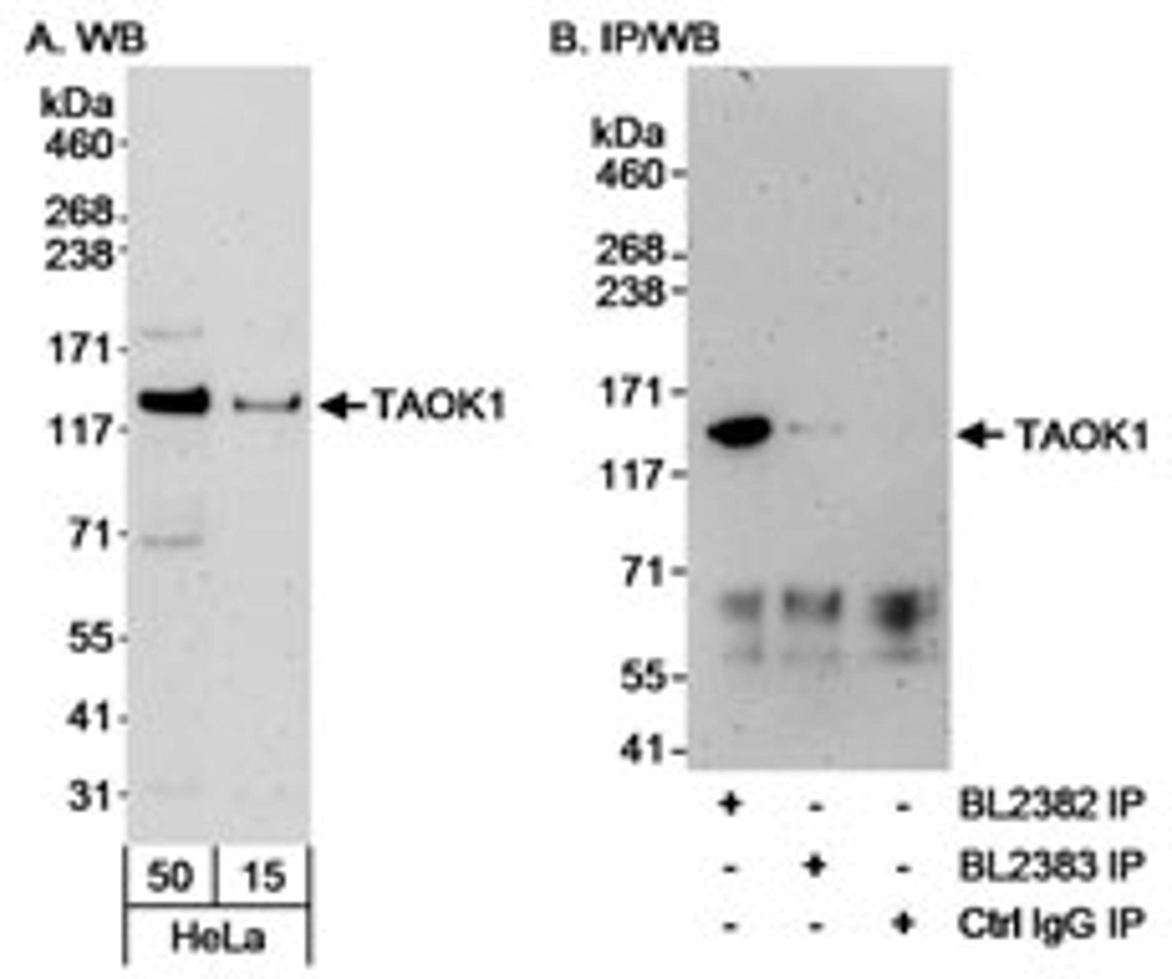 Detection of human TAOK1 by western blot and immunoprecipitation.