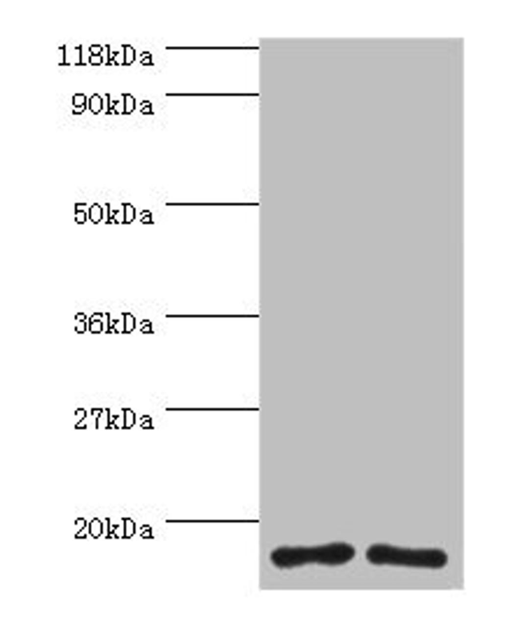 Western blot. All lanes: RPS16 protein antibody at 2µg/ml. Lane 1: 293T whole cell lysate. Lane 2: EC109 whole cell lysate. Secondary. Goat polyclonal to rabbit IgG at 1/15000 dilution. Predicted band size: 17 kDa. Observed band size: 17 kDa