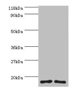 Western blot. All lanes: RPS16 protein antibody at 2µg/ml. Lane 1: 293T whole cell lysate. Lane 2: EC109 whole cell lysate. Secondary. Goat polyclonal to rabbit IgG at 1/15000 dilution. Predicted band size: 17 kDa. Observed band size: 17 kDa