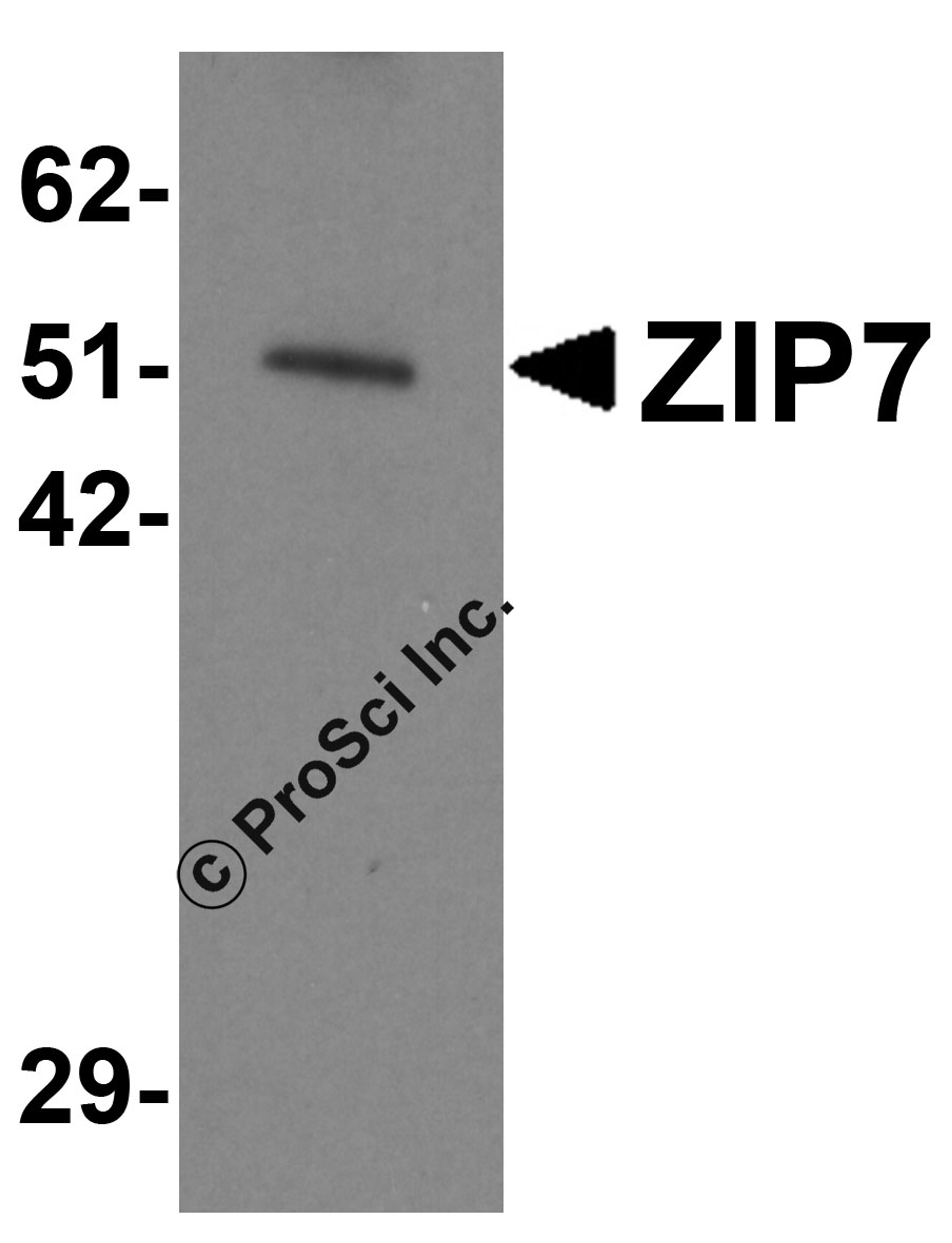 Western blot analysis of ZIP7 in mouse brain tissue lysate with ZIP7 antibody at 0.5 &#956;g/mL.