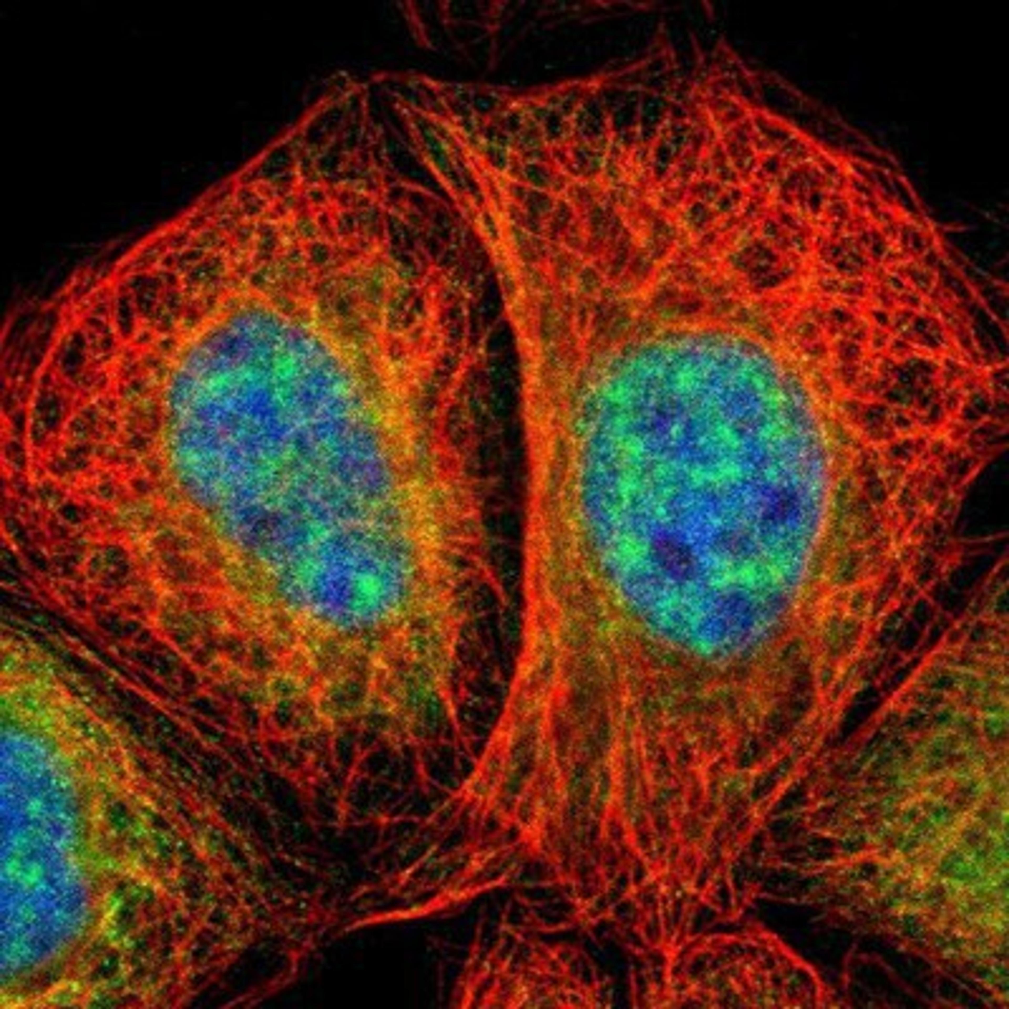 Immunocytochemistry/Immunofluorescence: TAP2 Antibody [NBP1-89312] Staining of human cell line A-431 shows positivity in nucleus but not nucleoli & endoplasmic reticulum.