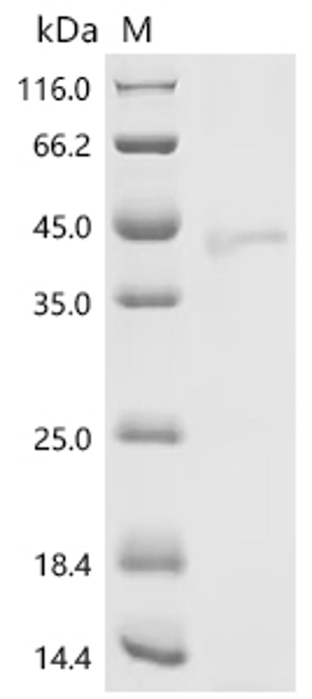 (Tris-Glycine gel) Discontinuous SDS-PAGE (reduced) with 5% enrichment gel and 15% separation gel.