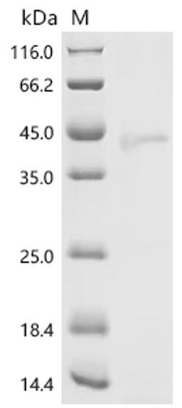 (Tris-Glycine gel) Discontinuous SDS-PAGE (reduced) with 5% enrichment gel and 15% separation gel.
