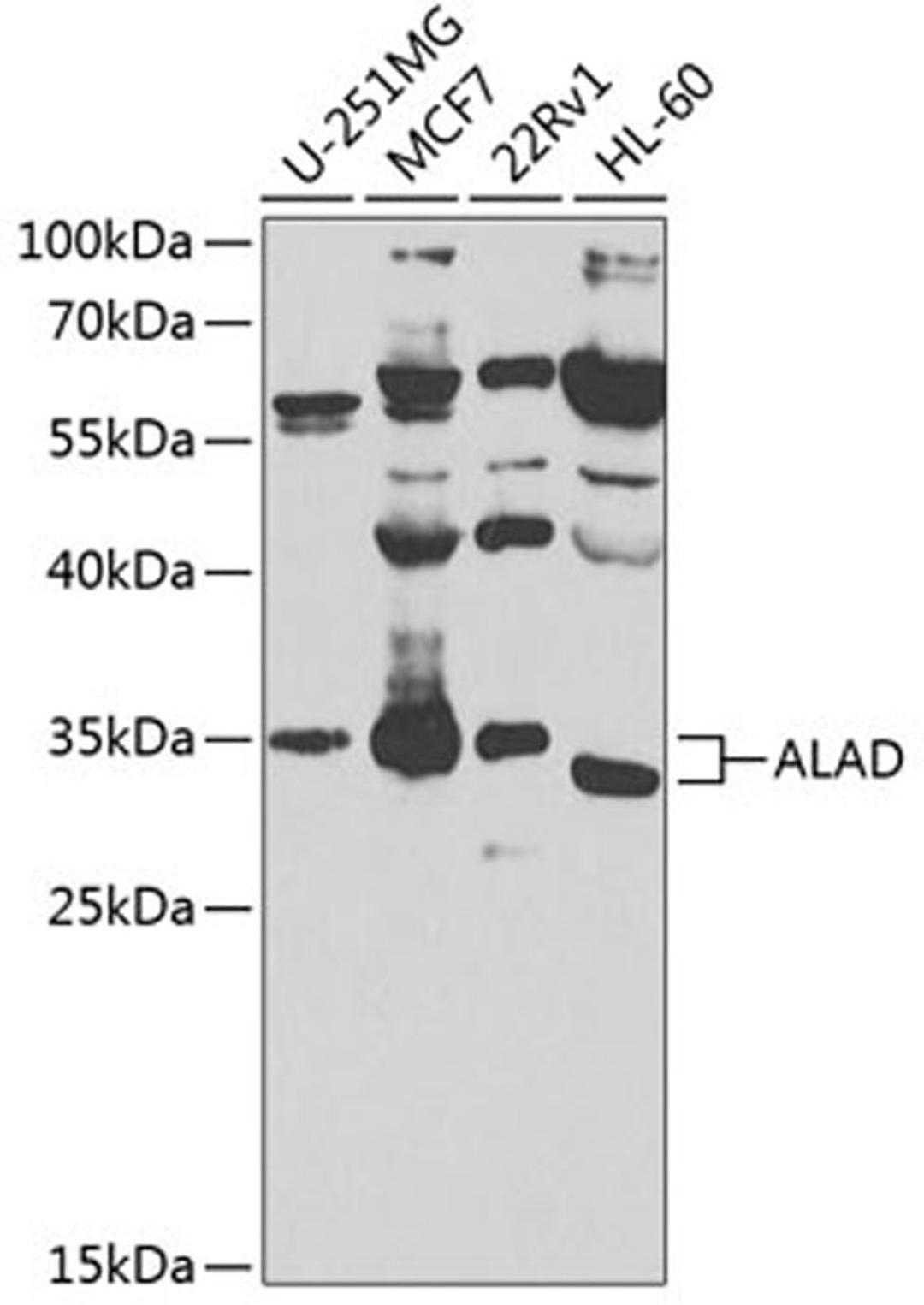 Western blot - ALAD antibody (A8398)