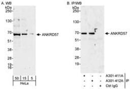 Detection of human ANKRD57 by western blot and immunoprecipitation.