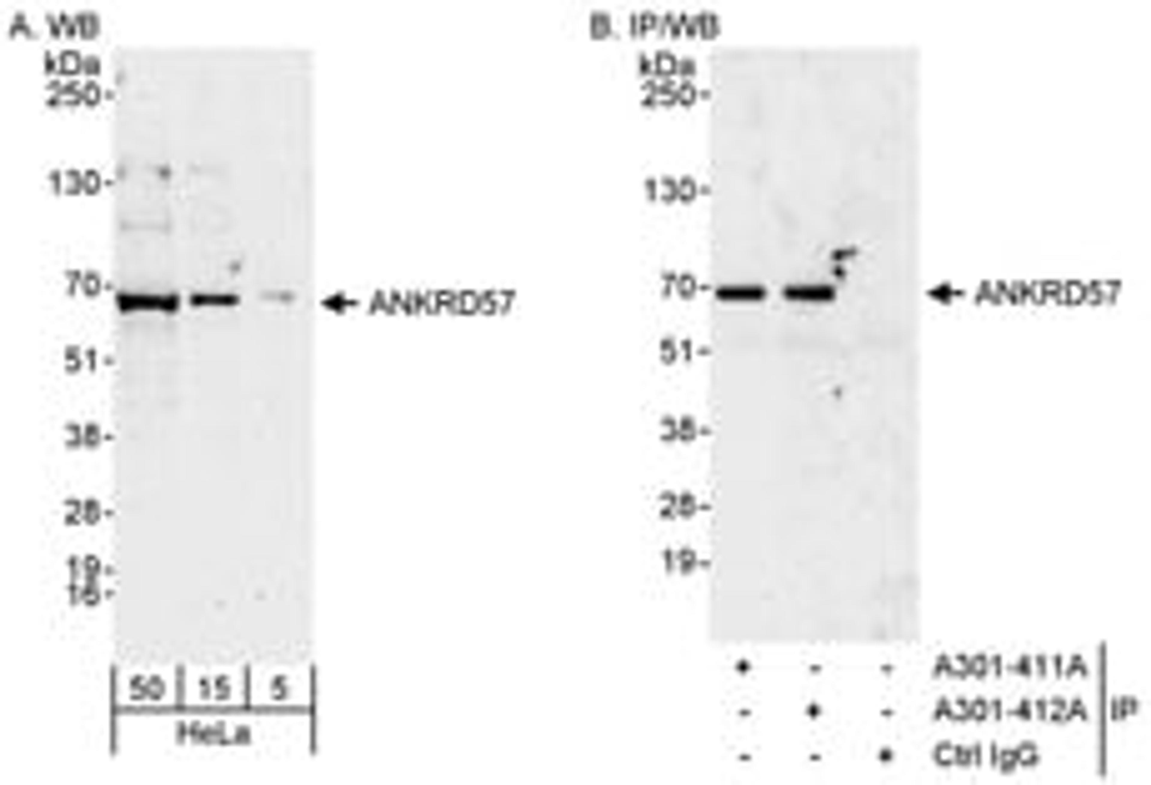 Detection of human ANKRD57 by western blot and immunoprecipitation.