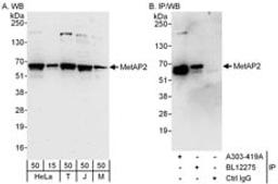 Detection of human and mouse MetAP2 by western blot (h and m) and immunoprecipitation (h).