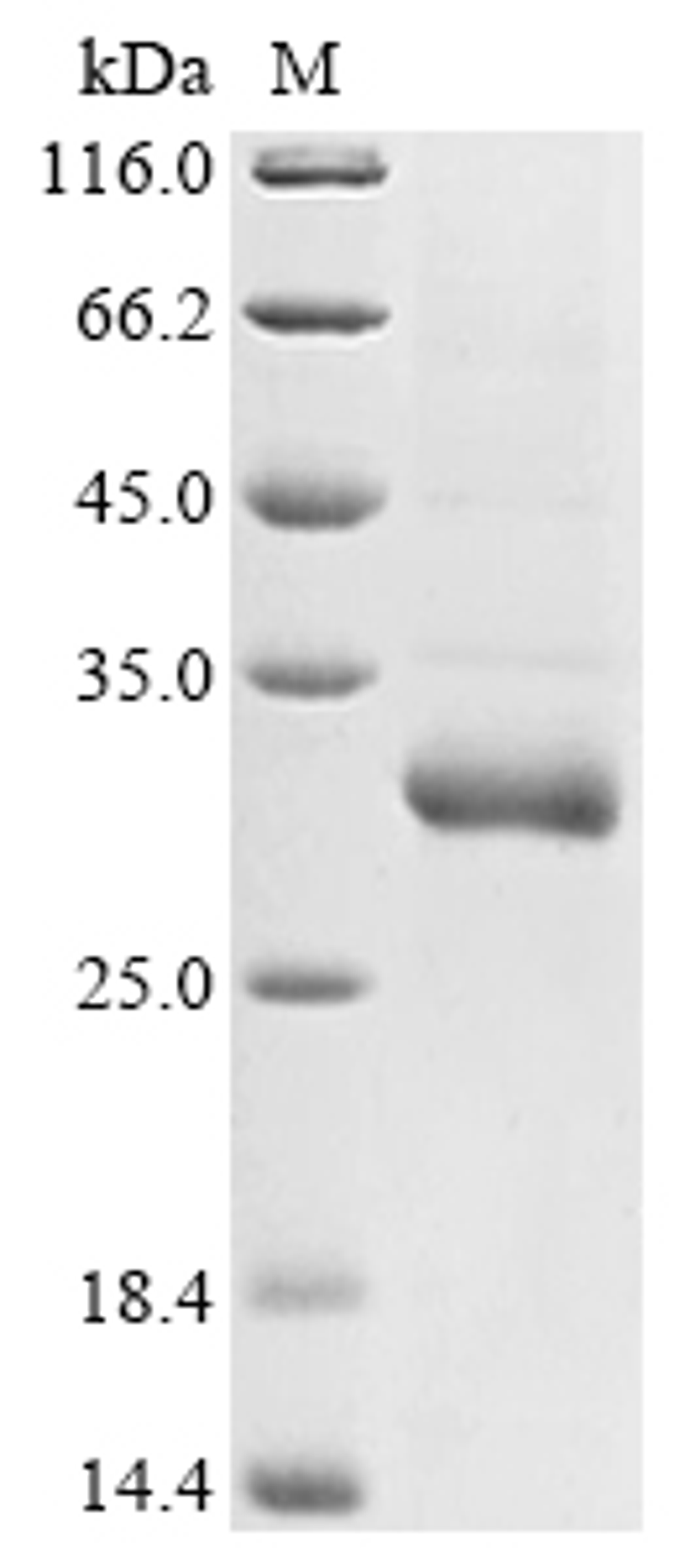 (Tris-Glycine gel) Discontinuous SDS-PAGE (reduced) with 5% enrichment gel and 15% separation gel.