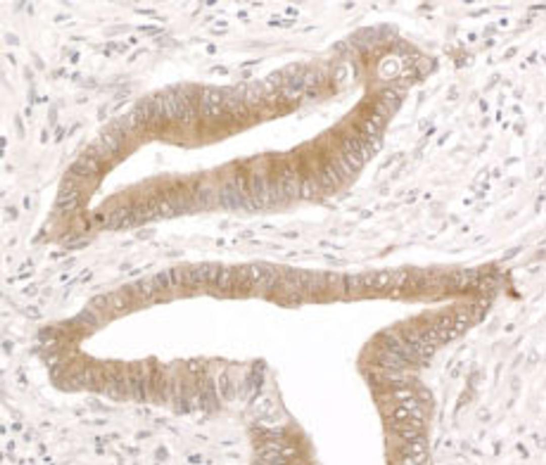 Detection of human RCN1 by immunohistochemistry.