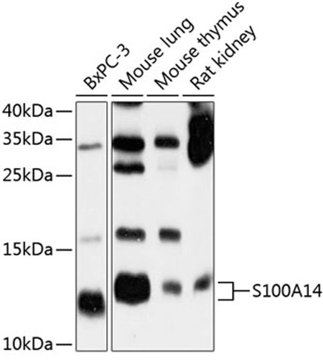 Western blot - S100A14 antibody (A10394)