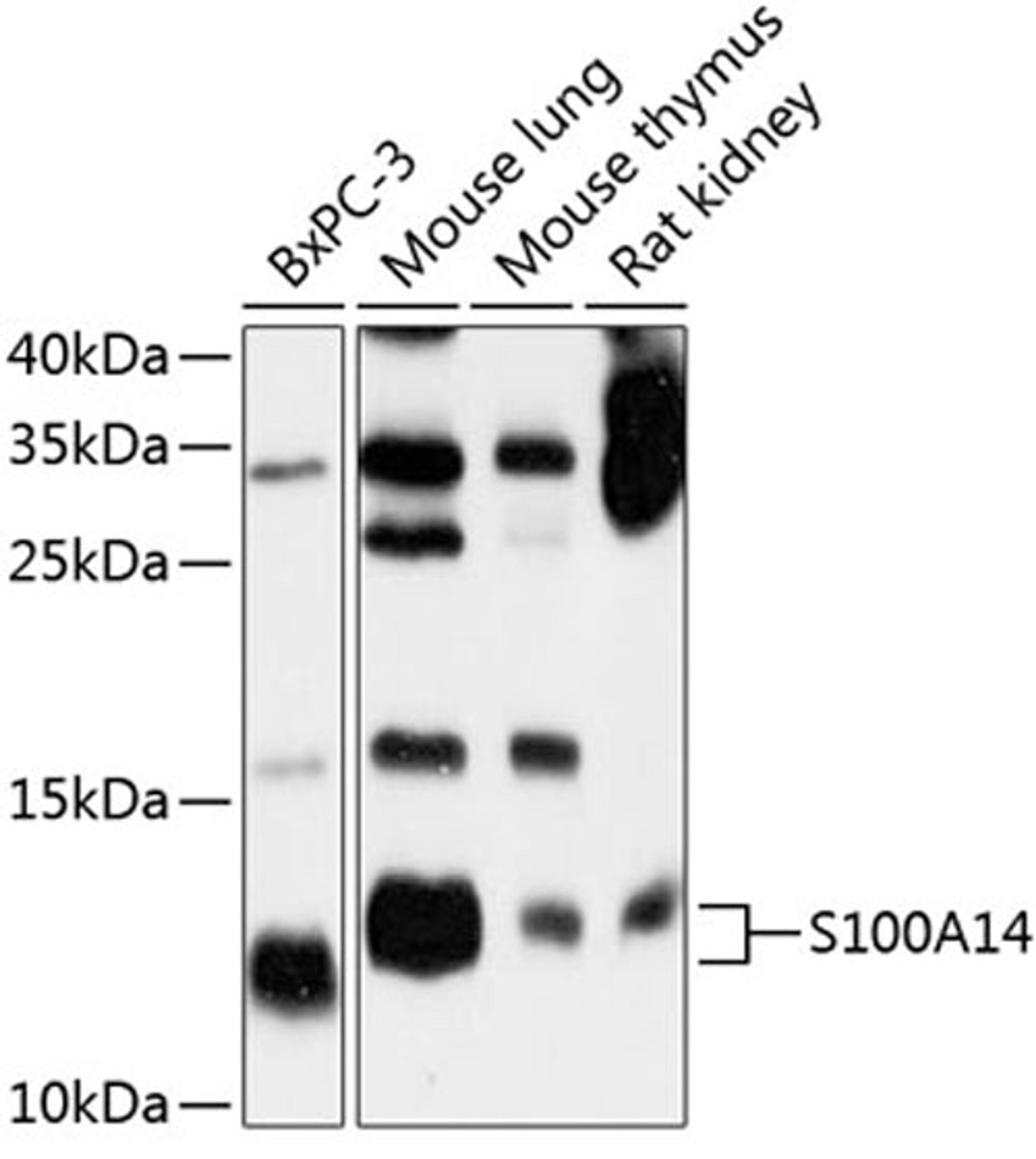 Western blot - S100A14 antibody (A10394)