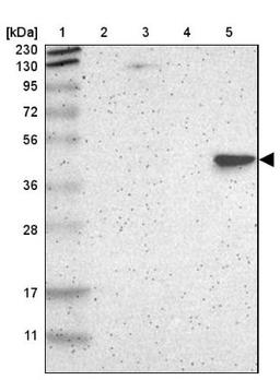 Western Blot: BBOX1 Antibody [NBP1-88695] - Lane 1: Marker [kDa] 230, 130, 95, 72, 56, 36, 28, 17, 11<br/>Lane 2: Human cell line RT-4<br/>Lane 3: Human cell line U-251MG sp<br/>Lane 4: Human plasma (IgG/HSA depleted)<br/>Lane 5: Human liver tissue