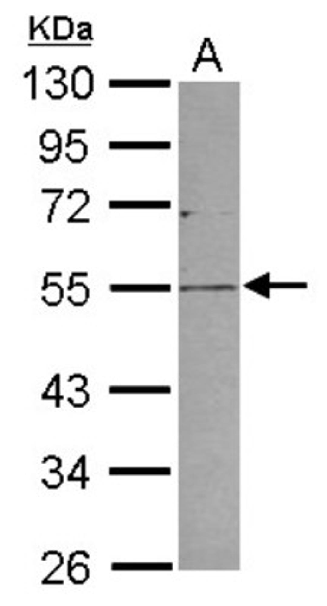 Western Blot: PLVAP Antibody [NBP2-19868] - Sample (30 ug of whole cell lysate) A: 293T 10% SDS PAGE gel, diluted at 1:1000.