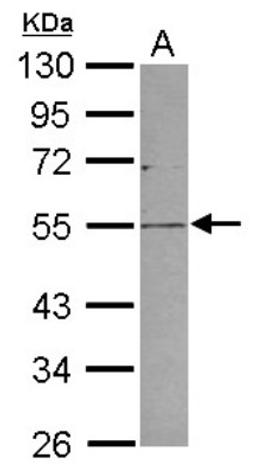 Western Blot: PLVAP Antibody [NBP2-19868] - Sample (30 ug of whole cell lysate) A: 293T 10% SDS PAGE gel, diluted at 1:1000.