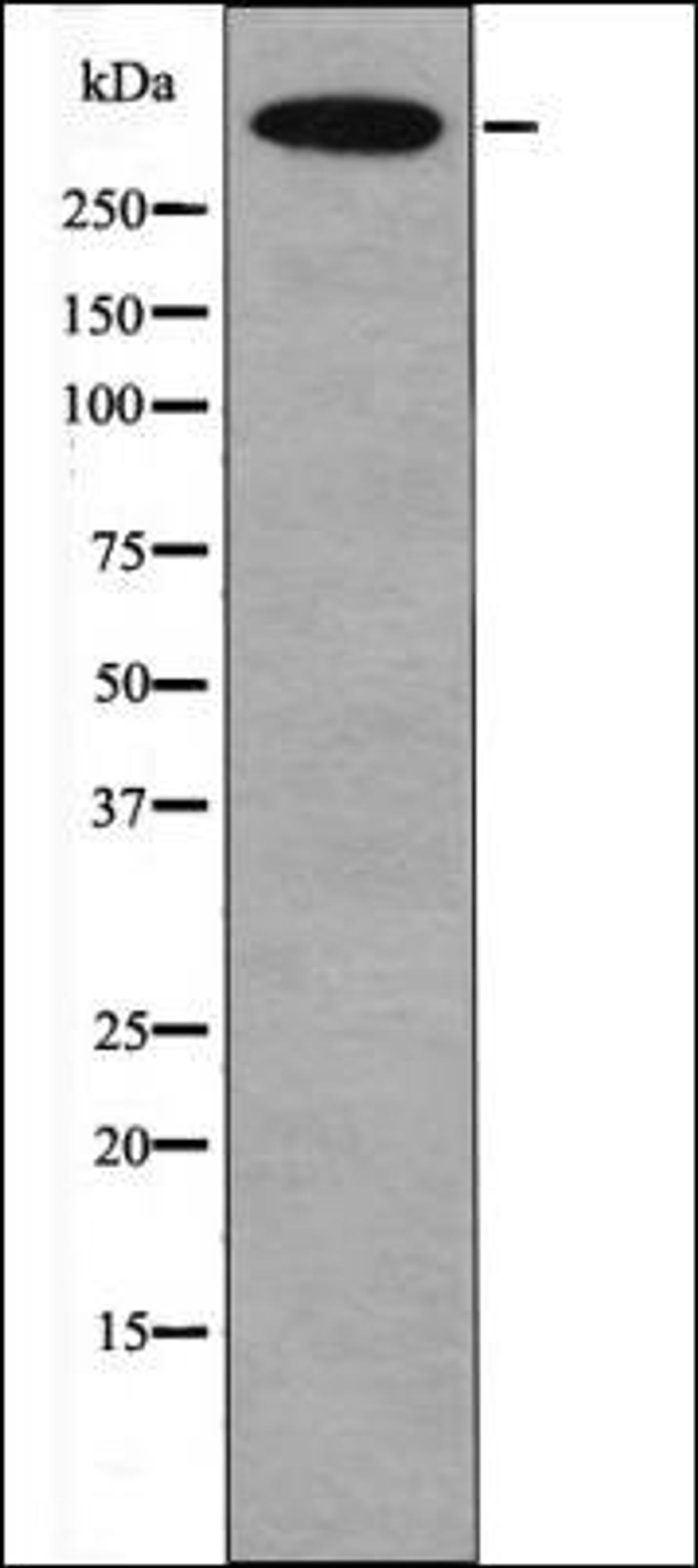 Western blot analysis of K562 whole cell lysates using DNA-PK -Phospho-Thr2609- antibody