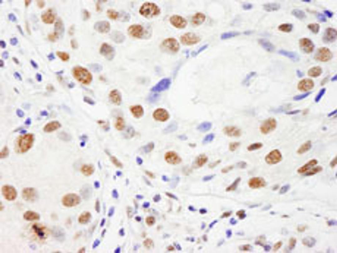 Detection of human NUMA by immunohistochemistry.