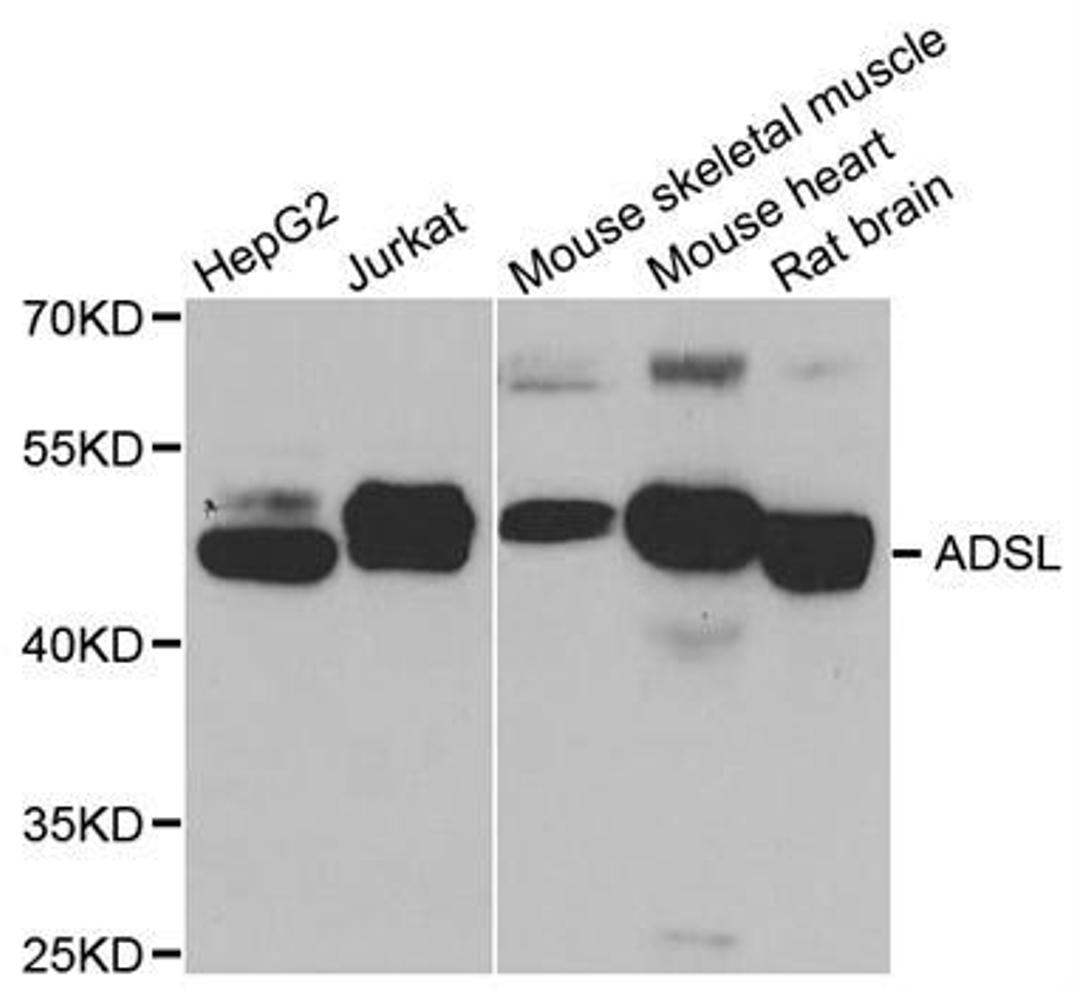 Western blot analysis of extracts of various cell lines using ADSL antibody