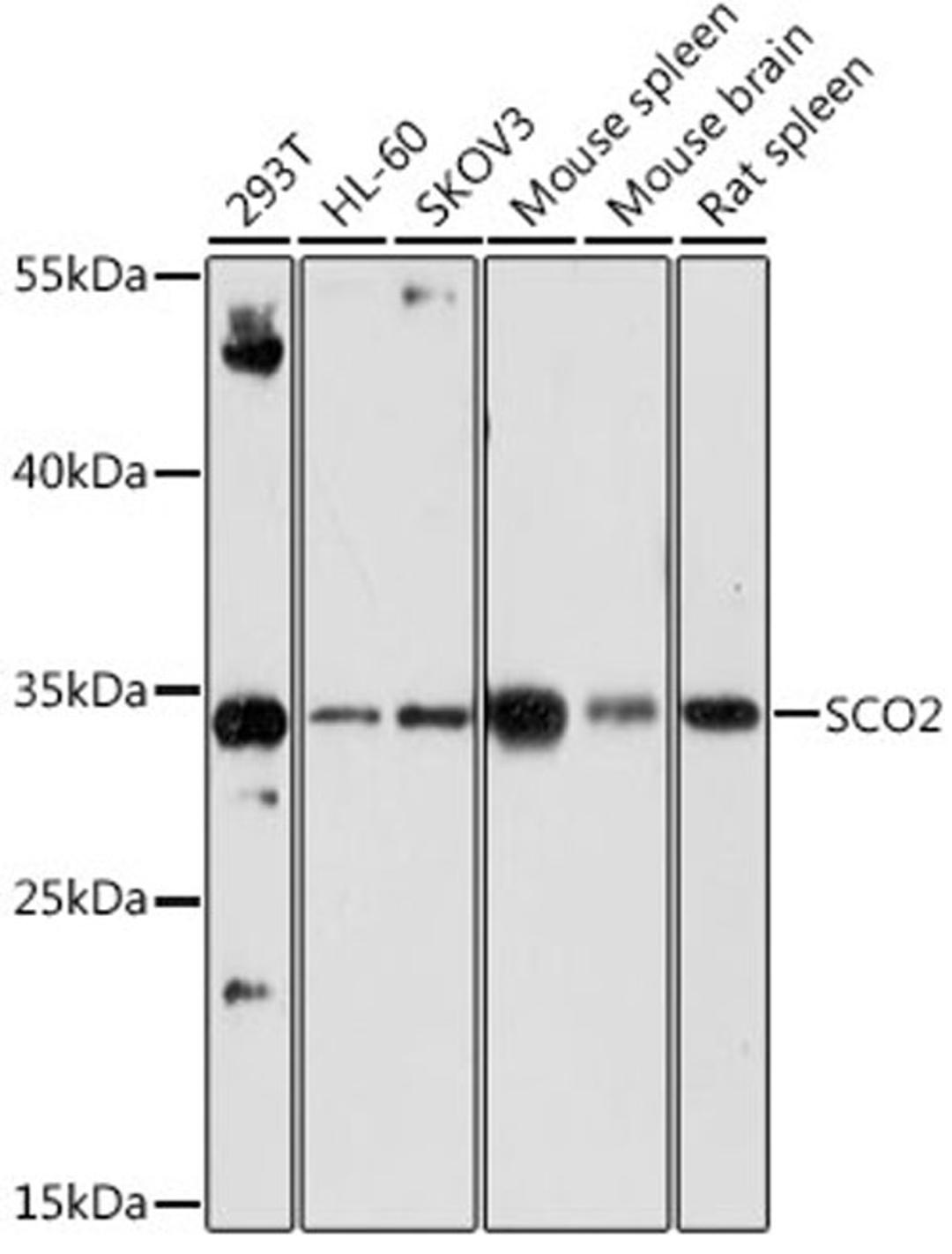 Western blot - SCO2 antibody (A7051)