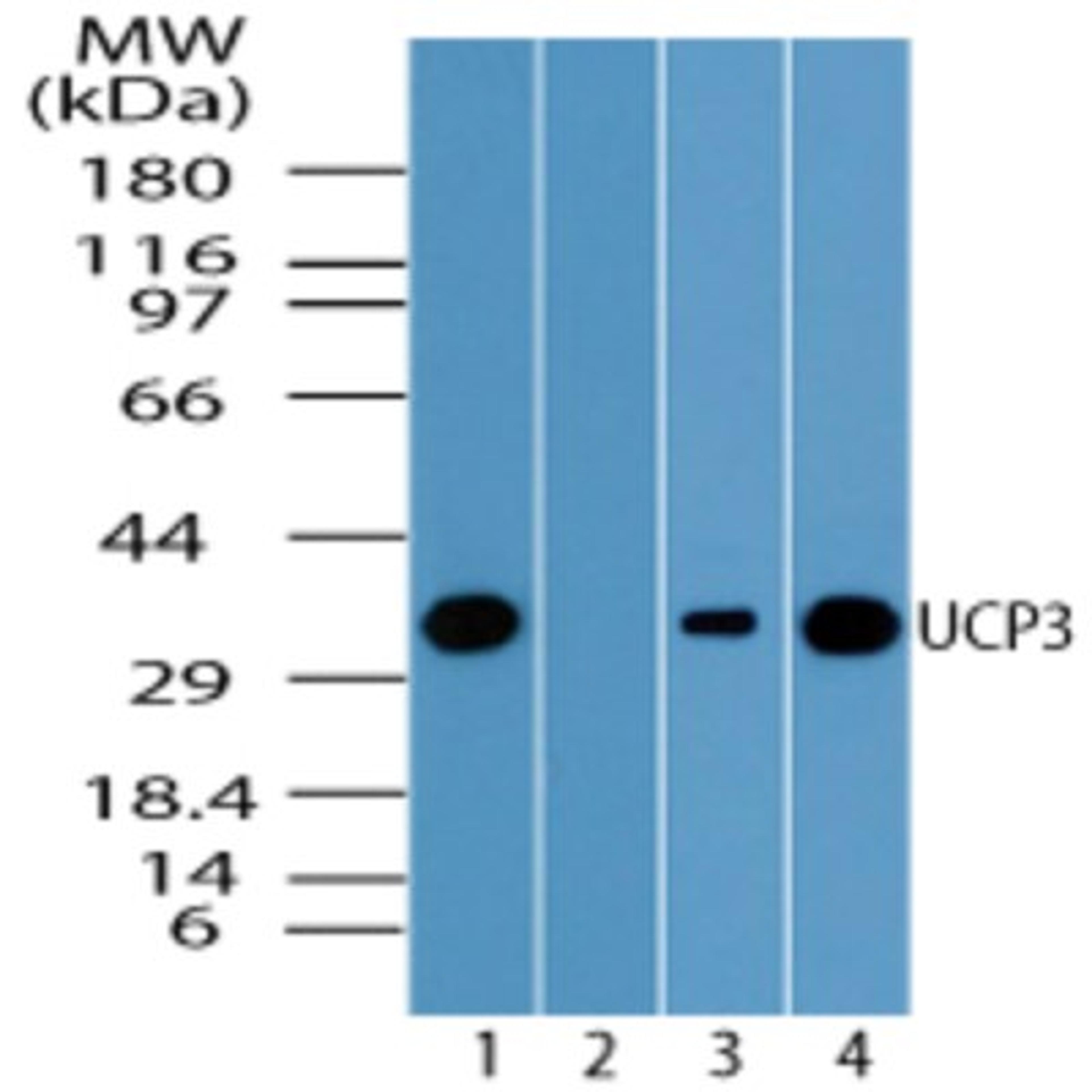 Western Blot: UCP3 Antibody [NBP2-24608] - analysis of UCP3 in human heart lysate in the 1) absence and 2) presence of immunizing peptide, 3) mouse heart and 4) rat heart using this antibody at 1.0 ug/ml.