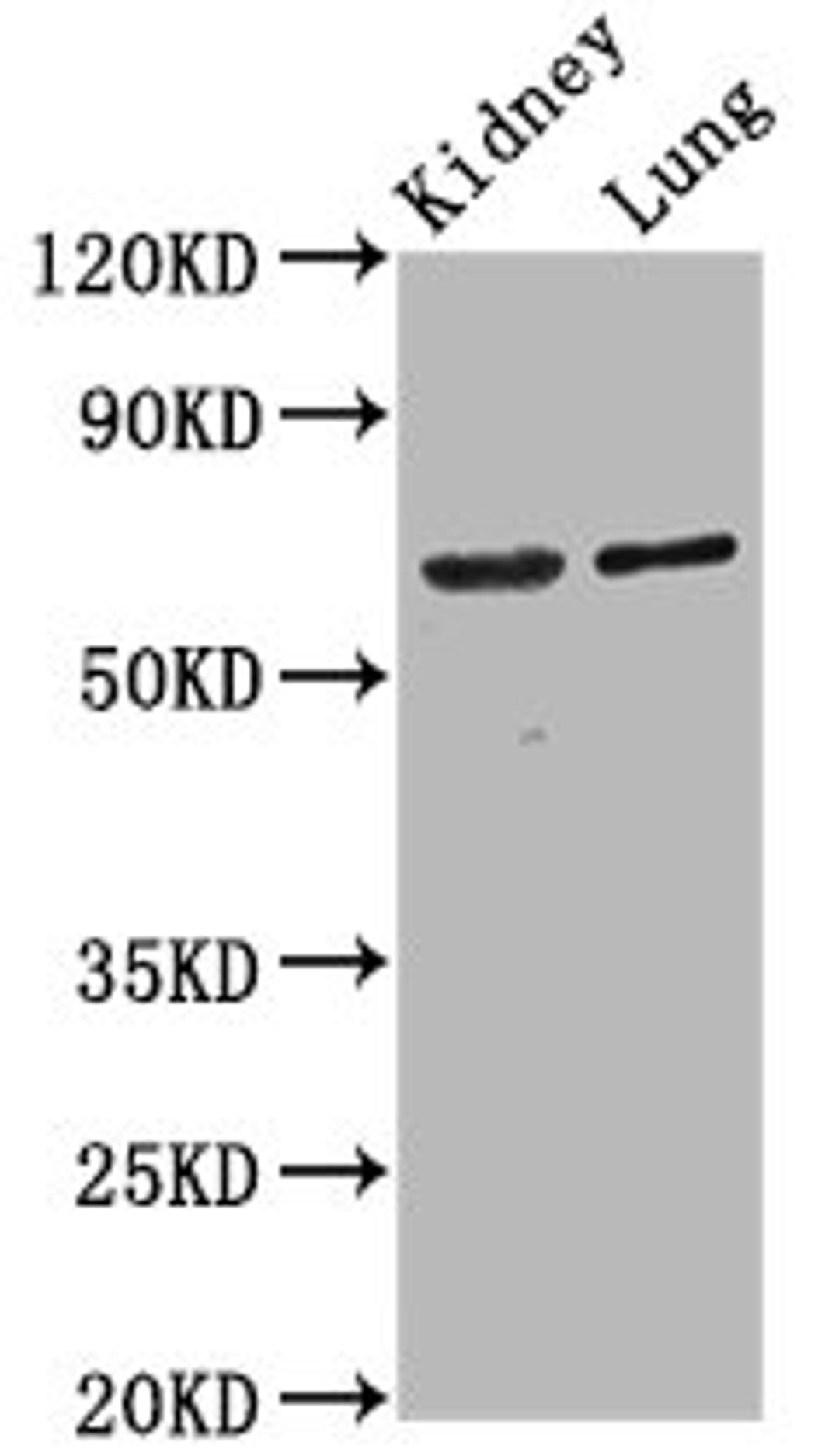 Western Blot. Positive WB detected in: Rat kidney tissue, Mouse lung tissue. All lanes: SRRM4 antibody at 4.2ug/ml. Secondary. Goat polyclonal to rabbit IgG at 1/50000 dilution. Predicted band size: 69 kDa. Observed band size: 69 kDa.