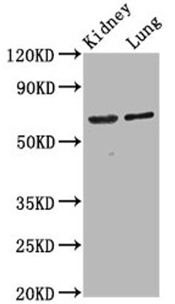 Western Blot. Positive WB detected in: Rat kidney tissue, Mouse lung tissue. All lanes: SRRM4 antibody at 4.2ug/ml. Secondary. Goat polyclonal to rabbit IgG at 1/50000 dilution. Predicted band size: 69 kDa. Observed band size: 69 kDa.