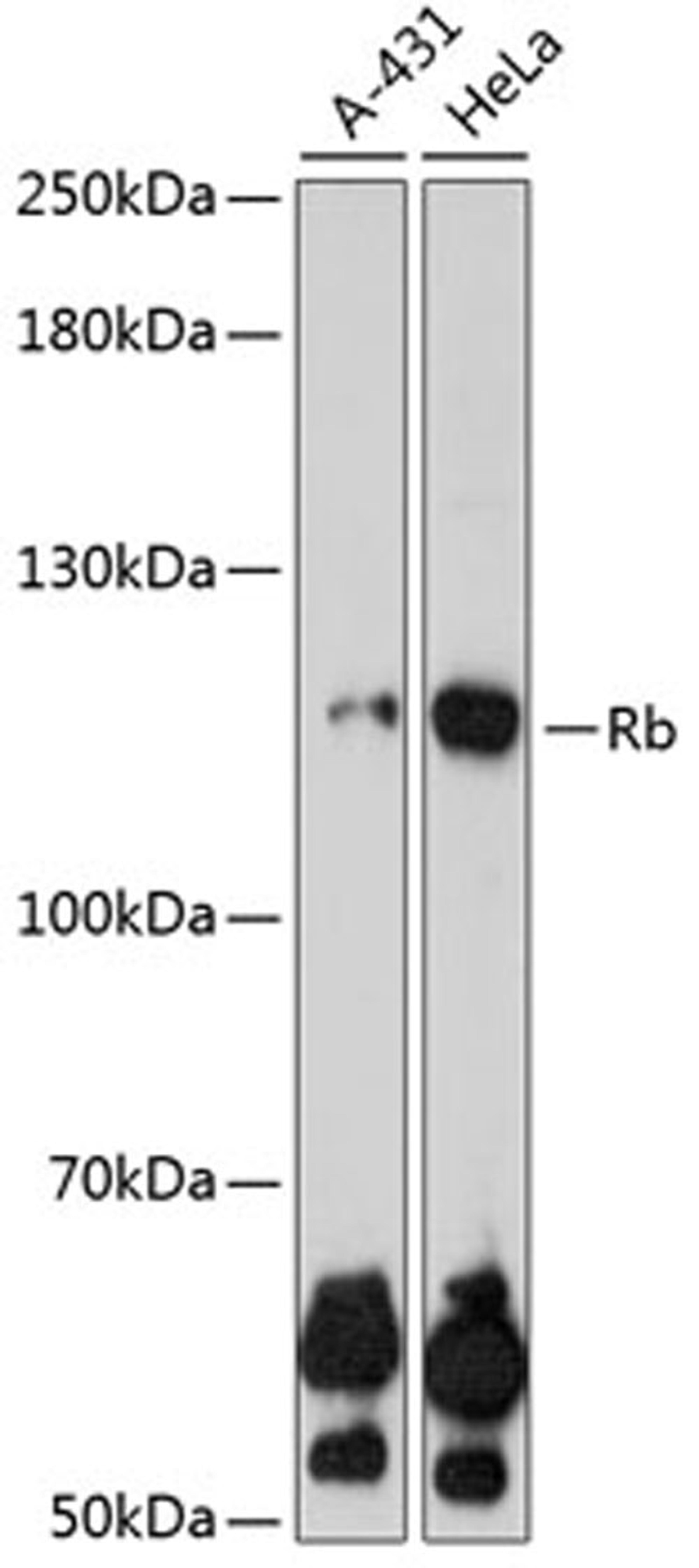 Western blot - Rb antibody (A0003)