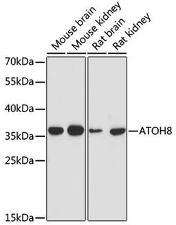 Western blot - ATOH8 antibody (A17232)