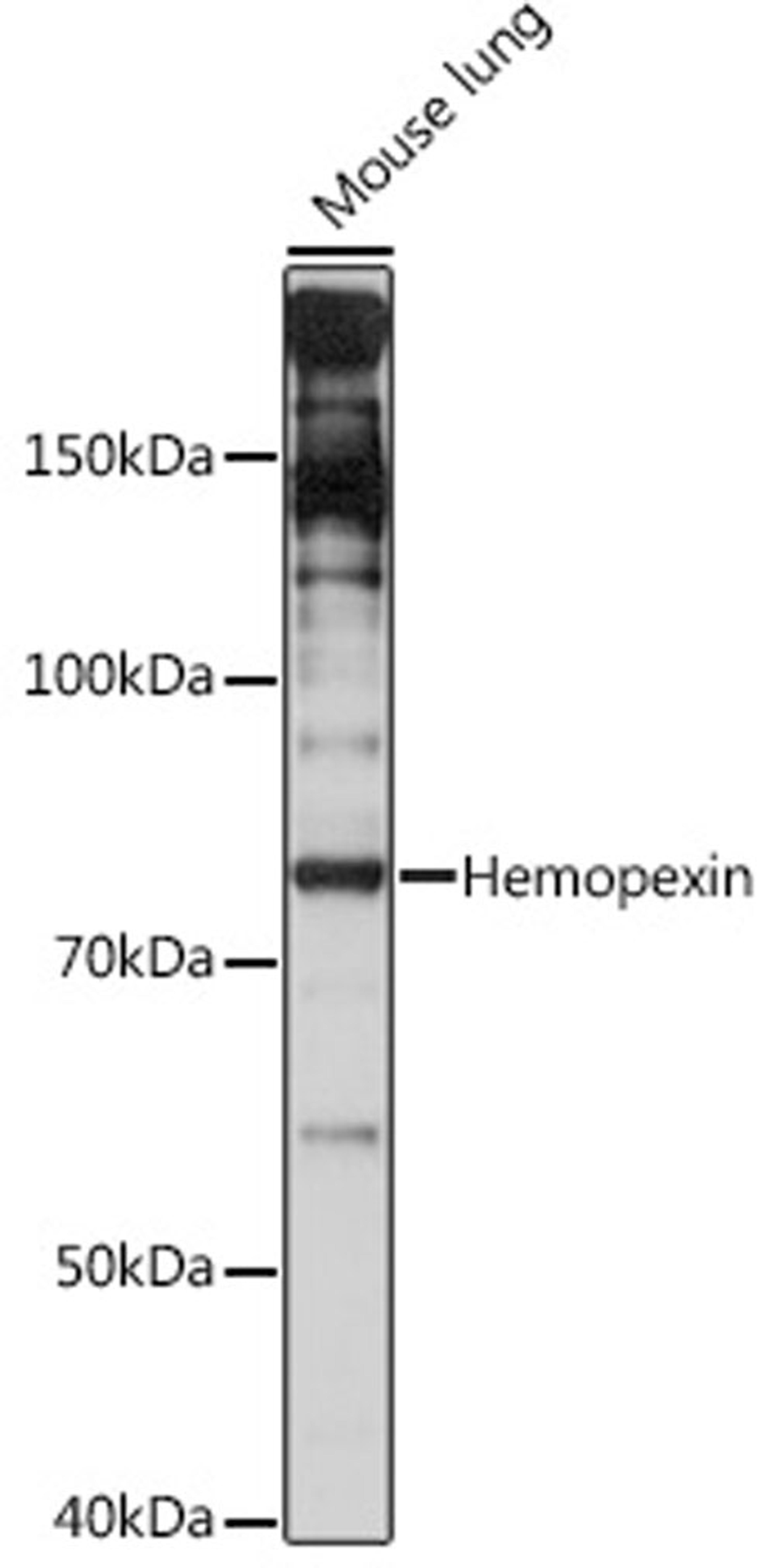 Western blot - Hemopexin Rabbit mAb (A9133)