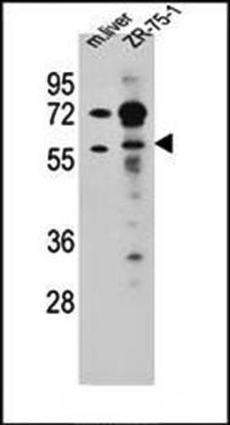 Western blot analysis of TRIM62 antibody in mouse liver tissue and ZR-75-1 cell line lysates