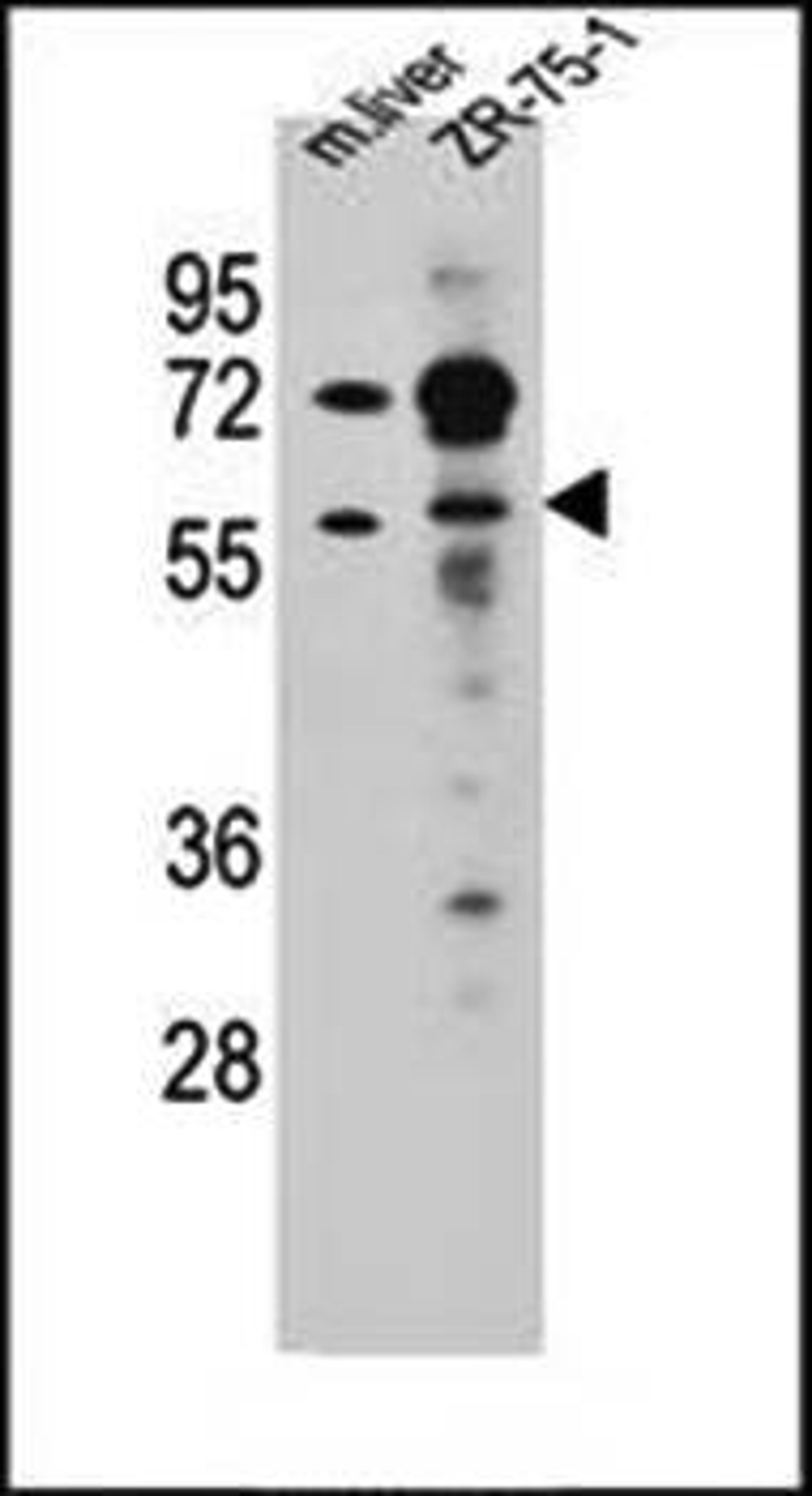 Western blot analysis of TRIM62 antibody in mouse liver tissue and ZR-75-1 cell line lysates