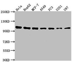Western Blot. Positive WB detected in: Hela whole cell lysate, HepG2 whole cell lysate, MCF-7 whole cell lysate, A549 whole cell lysate, PC3 whole cell lysate, U251 whole cell lysate, U87 whole cell lysate. All lanes: ACTN1 antibody at 1:2000. Secondary. Goat polyclonal to rabbit IgG at 1/50000 dilution. Predicted band size: 104, 103, 106, 108 kDa. Observed band size: 104 kDa. 