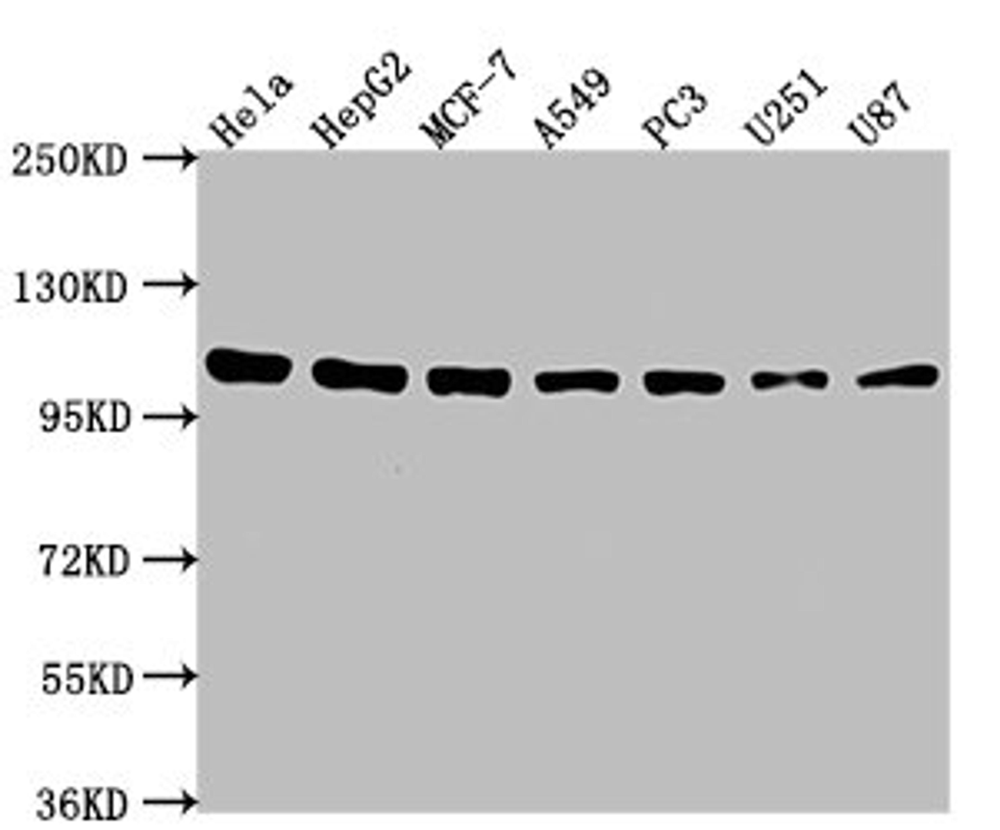 Western Blot. Positive WB detected in: Hela whole cell lysate, HepG2 whole cell lysate, MCF-7 whole cell lysate, A549 whole cell lysate, PC3 whole cell lysate, U251 whole cell lysate, U87 whole cell lysate. All lanes: ACTN1 antibody at 1:2000. Secondary. Goat polyclonal to rabbit IgG at 1/50000 dilution. Predicted band size: 104, 103, 106, 108 kDa. Observed band size: 104 kDa. 