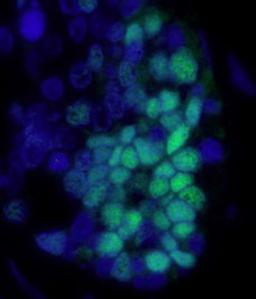 Detection of human p53 by immunofluorescence.