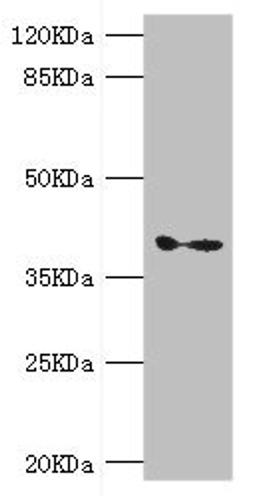 Western blot. All lanes: GDAP1 antibody at 1.11ug/ml + Mouse brain tissue. Secondary. Goat polyclonal to rabbit IgG at 1/10000 dilution. Predicted band size: 42, 34 kDa. Observed band size: 42 kDa.