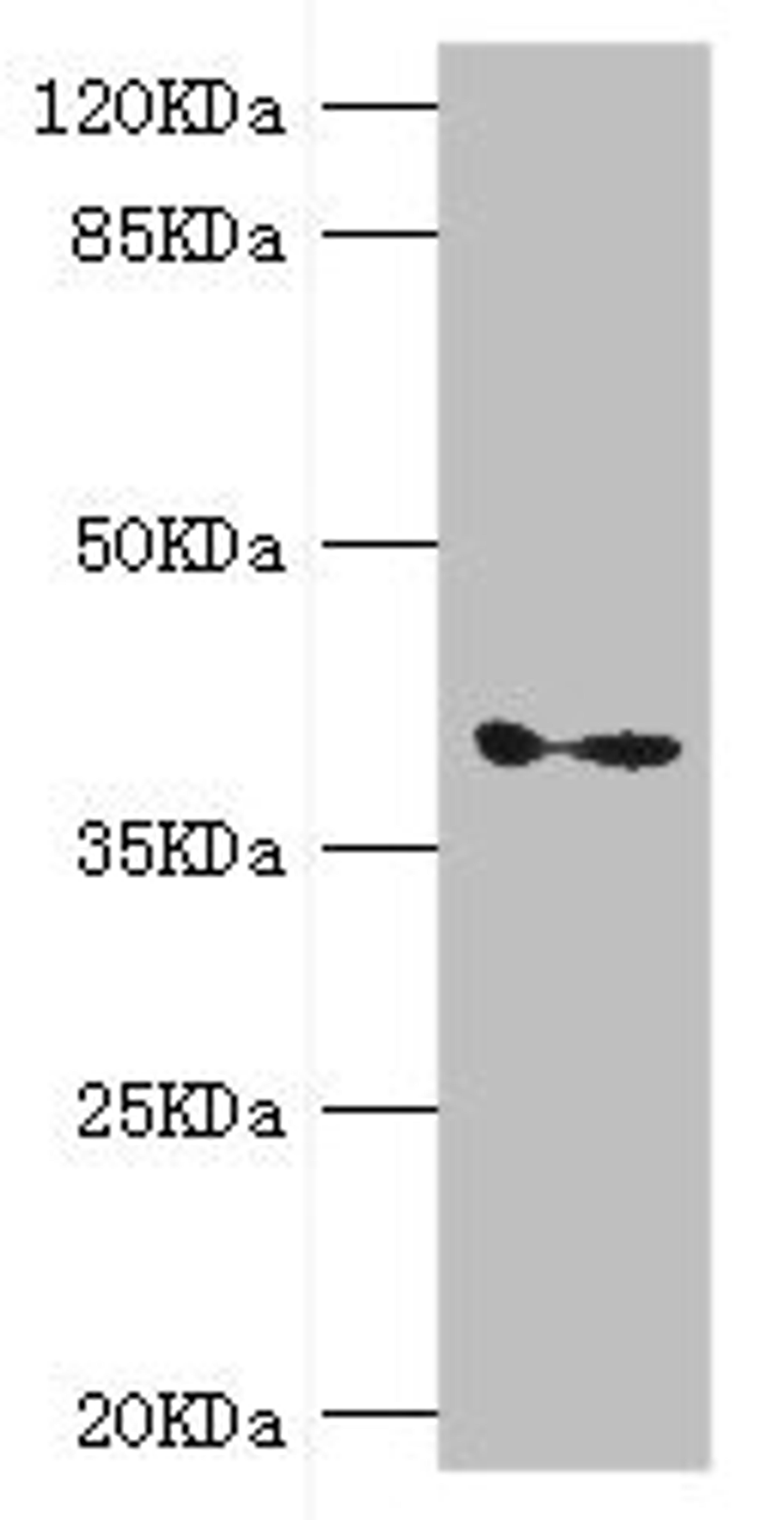 Western blot. All lanes: GDAP1 antibody at 1.11ug/ml + Mouse brain tissue. Secondary. Goat polyclonal to rabbit IgG at 1/10000 dilution. Predicted band size: 42, 34 kDa. Observed band size: 42 kDa.