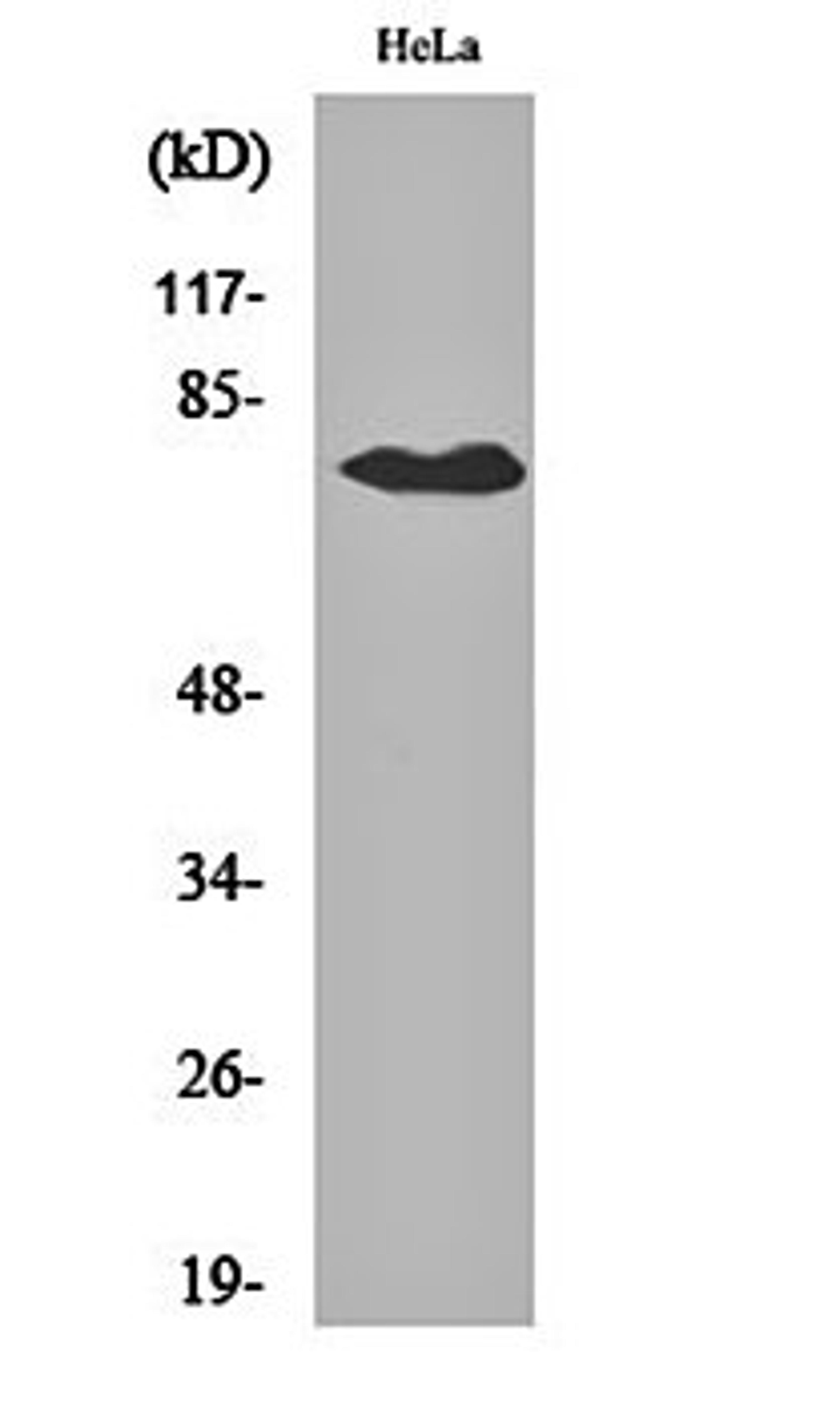 Western blot analysis of Hela cell lysates using OATP1 antibody