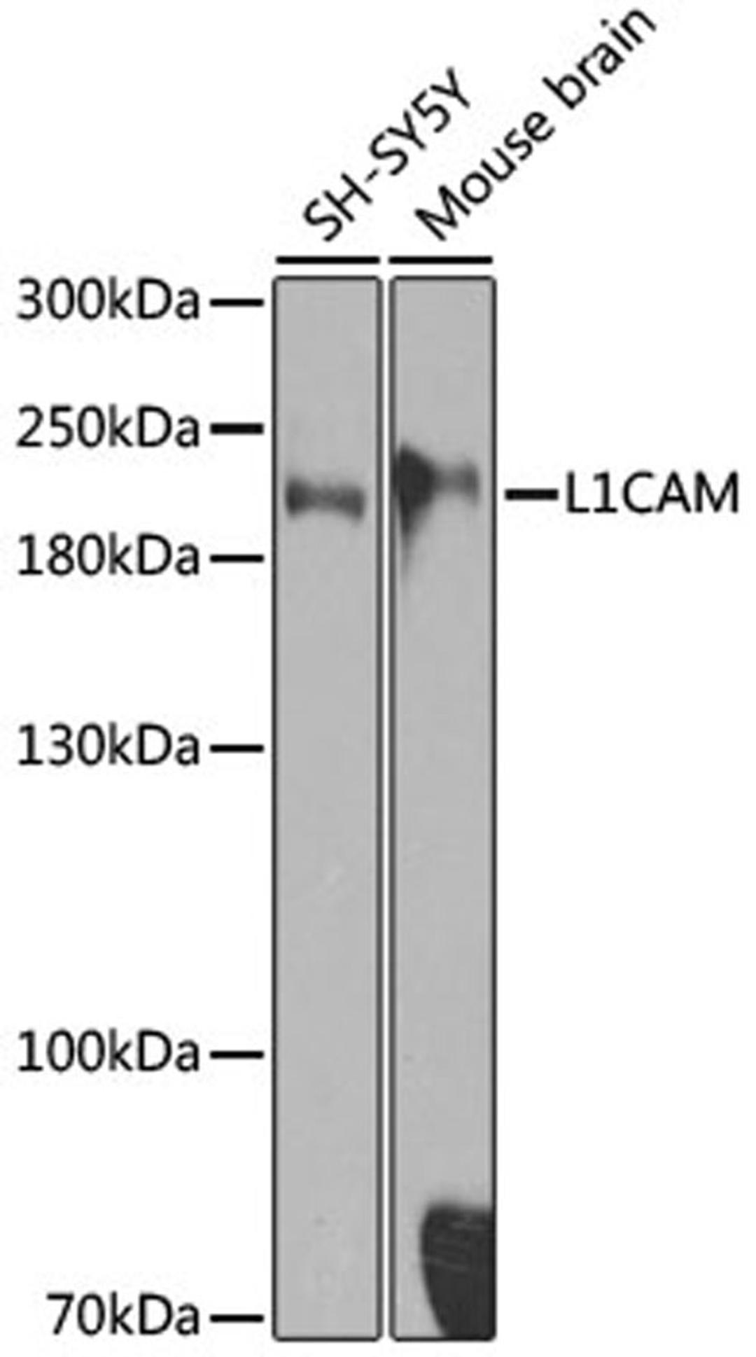 Western blot - L1CAM antibody (A8555)