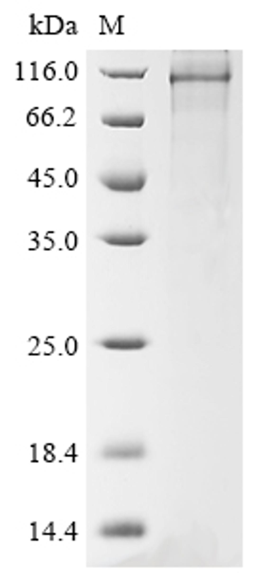 (Tris-Glycine gel) Discontinuous SDS-PAGE (reduced) with 5% enrichment gel and 15% separation gel.