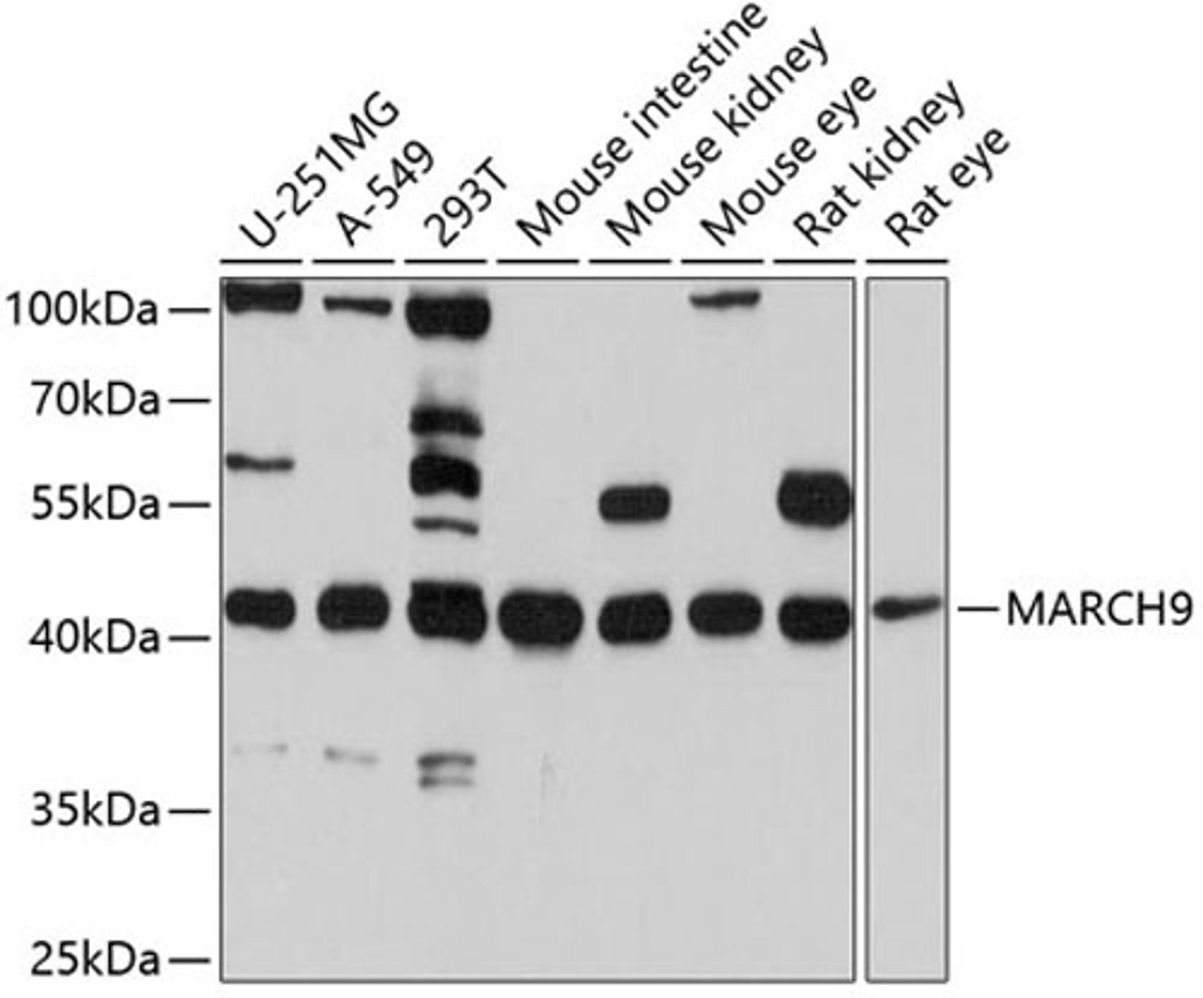 Western blot - MARCH9 antibody (A10596)