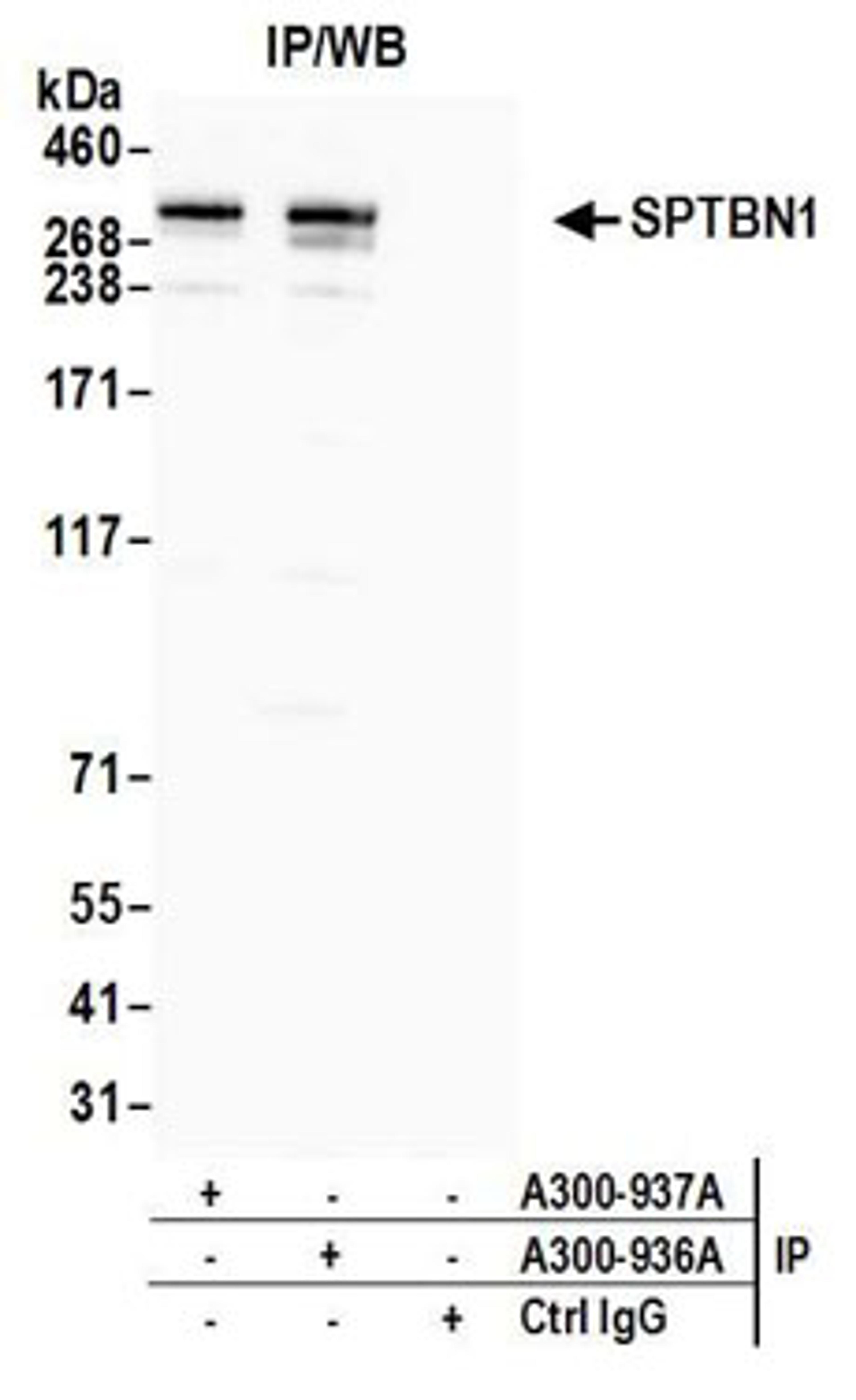 Detection of human SPTBN1 by western blot of immunoprecipitates.